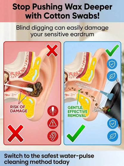 JS-2000mAh Long Battery Portable Manual Ear Cleaning Irrigator