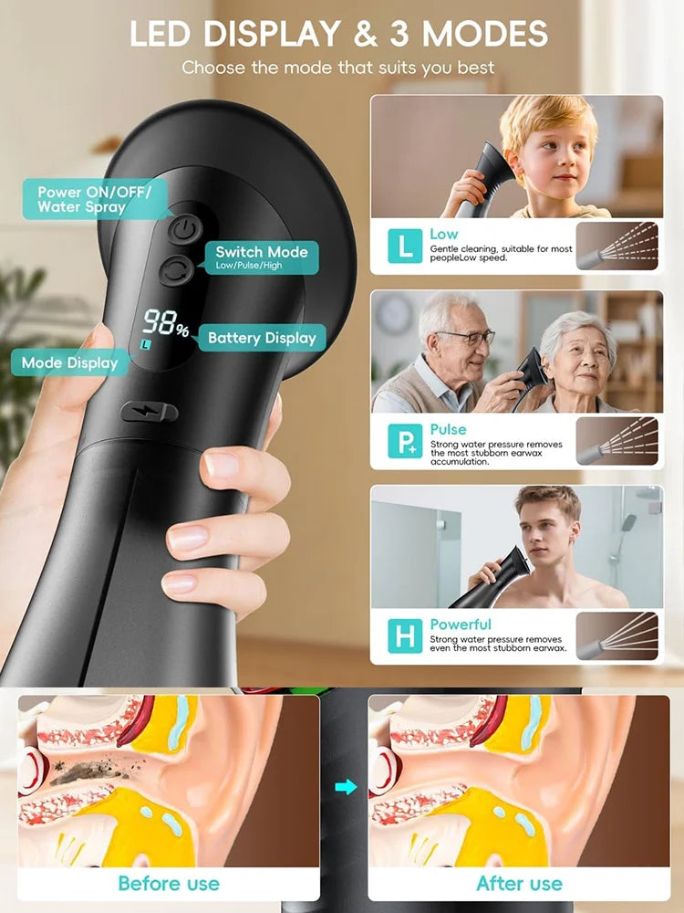 JS-2000mAh Long Battery Portable Manual Ear Cleaning Irrigator