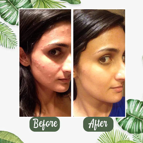 🌿Green Tea Deep Cleansing Mask Gentle